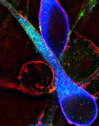 Neurônio visto ao microscópio de fluorescência